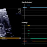FDA clears wave of fetal ultrasound AI, from biometry to anomaly